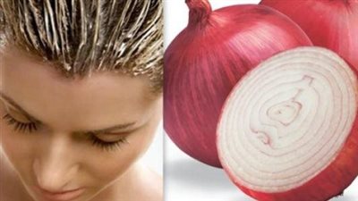 عصير البصل يحفز على نمو الشعر بعد تساقطه بنسبة 87% 