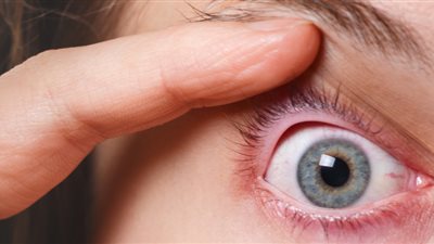 طرق إزالة البثور من منطقة جفن العين