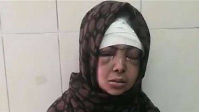 خروج سيدة الساطور بقنا من مستشفى سوهاج الجامعي بعد تحسن حالتها الصحية  