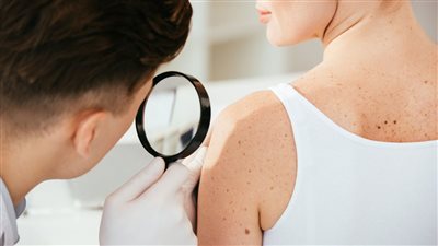 بريطانيا تكشف عن خطة طرح لقاح جديد مُنقذ لحياة مرضى سرطان الجلد