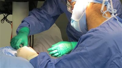 نجاح زراعة قوقعة في الأذن لطفل بالتأمين الصحي الشامل ببورسعيد (صور) 