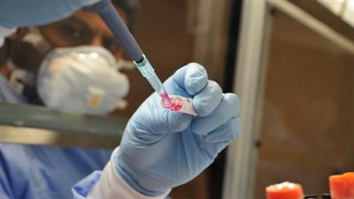 160 حالة جديدة.. سوهاج تسجل رقمًا قياسيًا في عدد إصابات كورونا اليومية