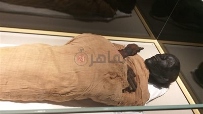 خبير آثار ينجح في إجراء عملية شرائح ومسامير على المومياوات | خاص