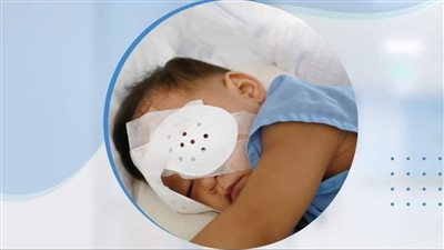 الرعاية الصحية تنقذ عين طفل صدمته دراجة نارية ببورسعيد