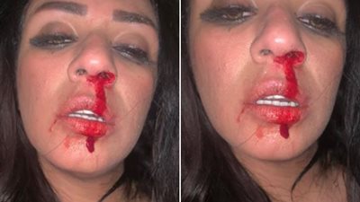 النيابة تستمع لأقوال المطربة شاهيناز في واقعة اعتداء زوجها عليها