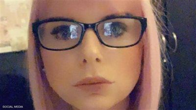 طلبوا الإسعاف.. “الفيلر” في المنزل يحول شفاه سيدة لشكل مرعب (صورة)