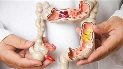 تغير لون البراز والسعال المستمر يُنذرك بسرطان الأمعاء.. احذر