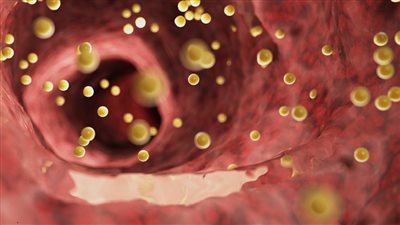 تعرف على طرق لخفض الكوليسترول الضار