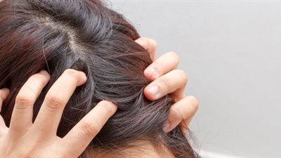 نصائح لتهدئة فروة الرأس خلال الصيف