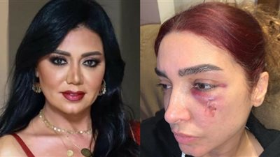 بعد إصابتها بجروح في الوجه.. رانيا يوسف توجه رسالة لـ روجينا