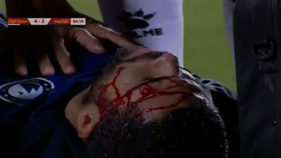 إصابة قوية لأحمد فتحي بعد تدخل بالكوع من لاعب سيراميكا