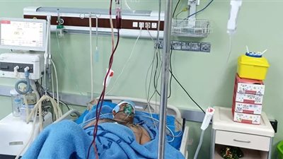 بعد تلقيه رصاصة في الرأس.. إعلامي عراقي يعود من الموت (صور)