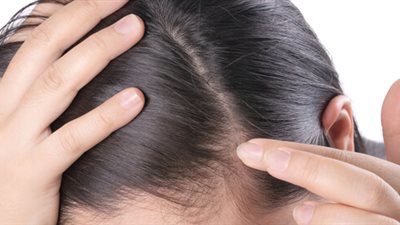 طرق سريعة لزيادة نمو الشعر 