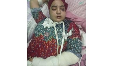 ألقاها والدها من الطابق الثالث.. ننشر صورة طفلة العياط بعد نجاتها من الموت (خاص) 