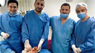 فريق طبي بجامعة المنوفية ينجح في إعادة يد مبتورة للحركة (صور) 