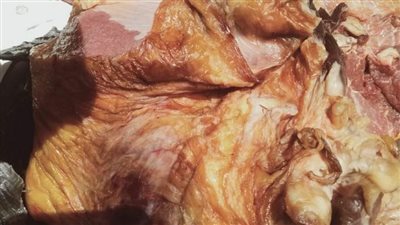  ضبط لحوم وكبدة مجمدة مجهولة المصدر بكفر الشيخ