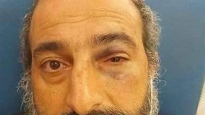 ثلاثة مستوطنين يعتدون على رجل دين مسيحي في القدس المحتلة (صورة) 