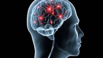 دراسة تكشف وجود علاقة بين الزبادي والزهايمر