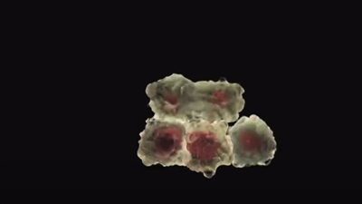 علماء يطورون تقنية للقضاء على السرطان وعلاج للرئتين في حالات كورونا (فيديو)