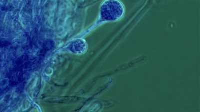 طبيب يحذر من تناول المضادات الحيوية دون استشارة: 