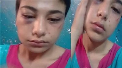 المشدد 10 سنوات لمغتصب فتاة الـ