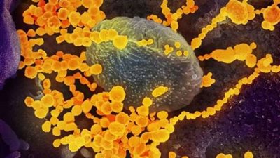 الهند تعلن وفاة أول مصاب بالفطر الأصفر 