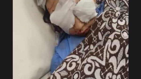 الطفلة المصابة ريتاج