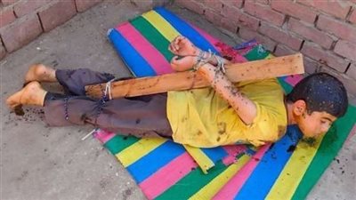 بعد حجز والده.. تفاصيل واقعة رش عسل على جسد طفل وترك الحشرات تنتشر عليه بالقليوبية  