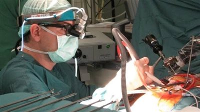 توسيع الصمام الأورطي بالبالون لمُسنة 60 عامًا بالتأمين الصحي الشامل ببورسعيد