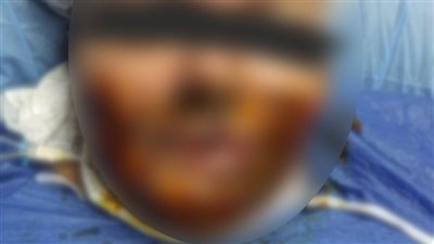 تصل إلى السجن المؤبد أو الإعدام.. خبير قانوني يوضح عقوبة المتهم بإلقاء 