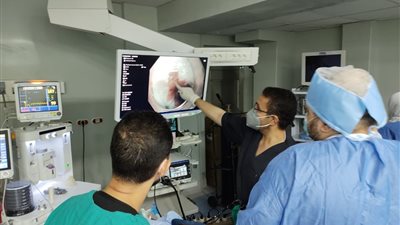 استئصال جيب من البلعوم دون جراحة لأول مرة بـ