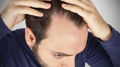 المادة الكيميائية التي تسبب الصلع هي ذاتها التي تقوم بعلاجه | دراسة 