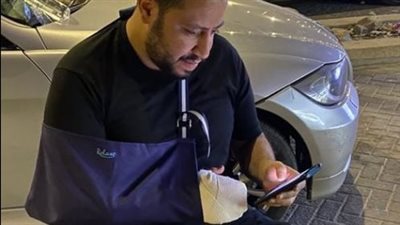 المنتج محمد كارتر يعلن إصابته بكسر في يده 