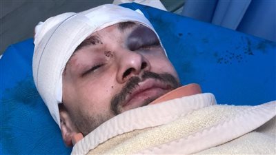 شاب يفقد ذاكرته بعد تلقيه ضربة بعصا بيسبول في الشارع (فيديو)