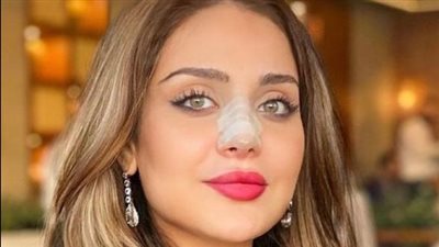 بعد خضوعها لعملية تجميل.. زينب فياض ابنة هيفاء وهبي تحتفل بعيد ميلادها (صور)