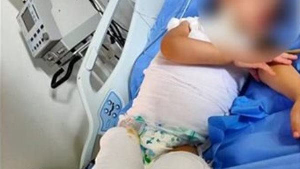  الطفلة ضحية التعذيب