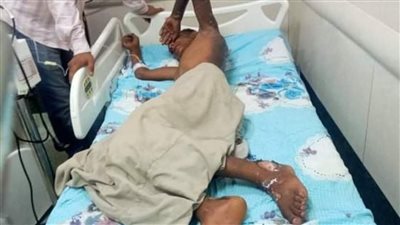 ضبط شاب أشعل النيران في آخر بسبب خلافات بينهما بالغربية