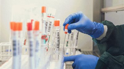 منصة عالمية تعتذر لفريق بحثي مصري بعد مزاعم الجارديان سرقة أبحاث عن كورونا