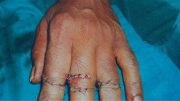 جراحة - تعبيرية