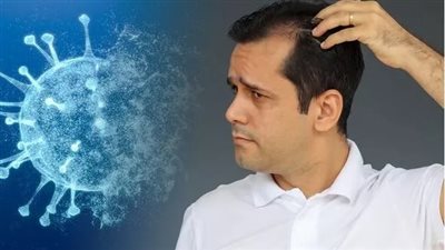 مفاجأة.. الإصابة بكورونا تتسبب في سقوط الشعر (تقرير علمي)