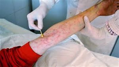 “رسالة رعب” إلى 560 مريض .. “اصابتكم بالإيدز محتملة”