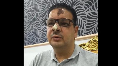 ما سألتش فينا.. فتاة مخمورة تدهس رجلًا وزوجته في حدائق الأهرام وتفر هاربة ( فيديو)