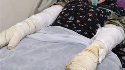 لخلافات على ثمن منزل.. عاطل يشعل النيران بنجل عمه ووالدته بالقناطر الخيرية 