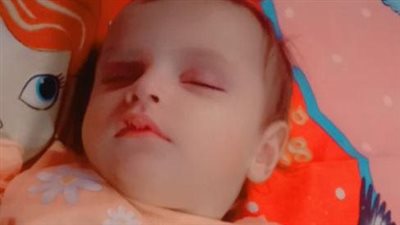 بعد نشر القاهرة 24.. وزارة الصحة تستجيب لاستغاثة الطفلة رودينا المصابة بضمور العضلات