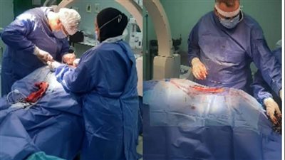 إجراء عملية تثبيت فقرات وإصلاح اعوجاج بالعمود الفقري لفتاة عشرينية بالبحيرة