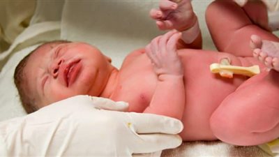 أطباء هنود ينجحون في إزالة ورم نادر من قلب طفل حديث الولادة