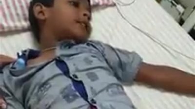 يلهث بلسانه ويصدر صوت النباح.. إصابة طفل بداء الكلب بعد تعرضه للعض «فيديو»