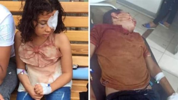 الأطفال المصابة بعرس