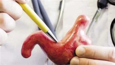 هل يمكن إجراء جراحات السمنة لكبار السن؟.. استشاري يجيب