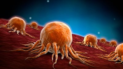 اكتشاف جديد يساعد في مكافحة مرض السرطان | دراسة